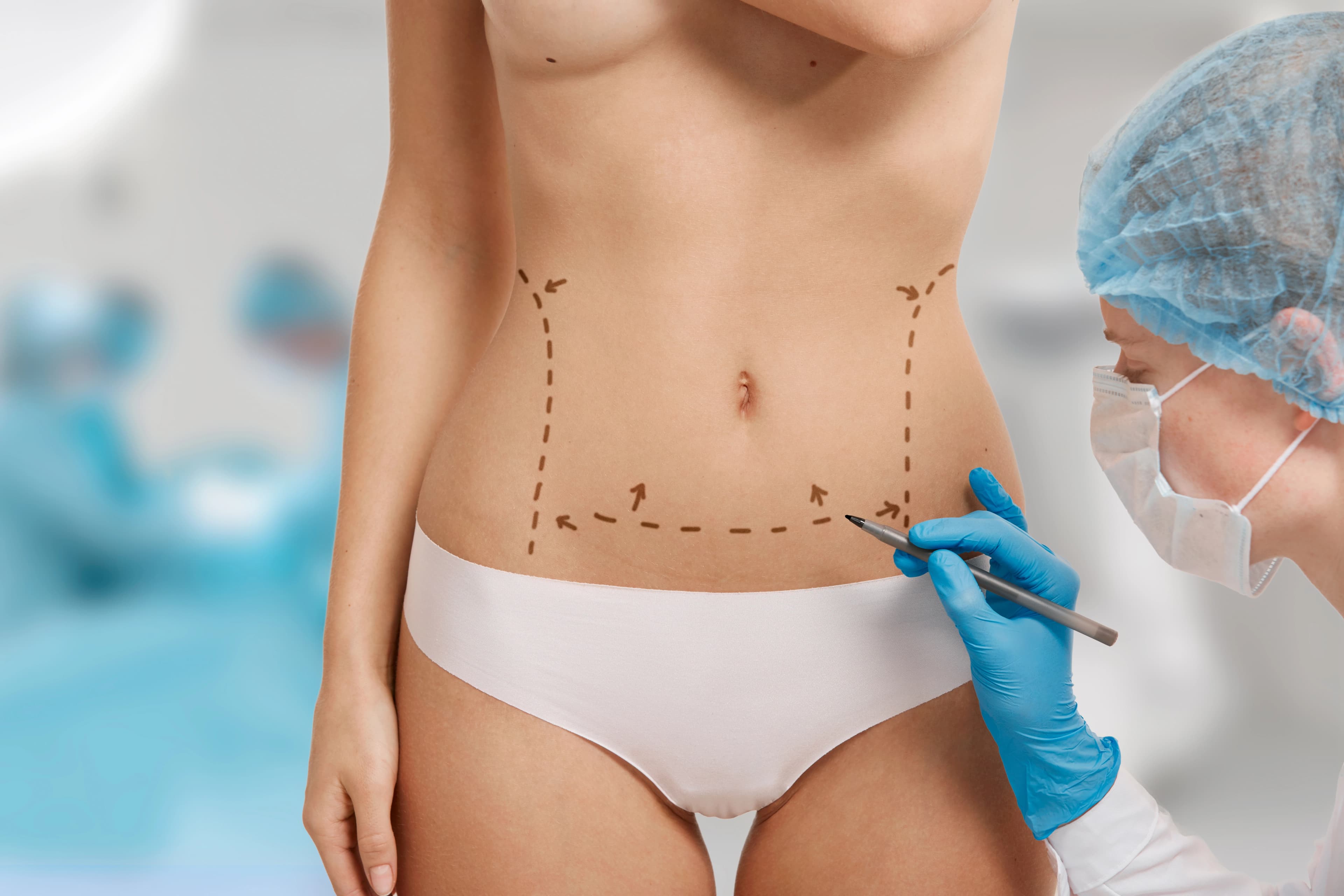 Tummy Tuck in Turkey